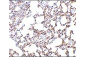 Immunohistochemistry of SnoN in mouse lung tissue with this product at 5 μg/ml.
