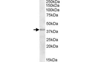 TXNDC6 polyclonal antibody  (2 ug/mL) staining of human uterus lysate (35 ug protein in RIPA buffer).