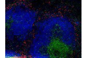 Immunofluorescence (IF) image for anti-Integrin beta 2 (ITGB2) antibody (Alexa Fluor 594) (ABIN2656819) (Integrin beta 2 抗体  (Alexa Fluor 594))