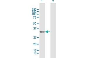 Western Blot analysis of PROSC expression in transfected 293T cell line by PROSC MaxPab polyclonal antibody. (PROSC 抗体  (AA 1-275))