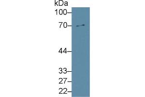 Western Blot; Sample: Rat Liver lysate; Primary Ab: 2µg/ml Rabbit Anti-Rat MMP8 Antibody Second Ab: 0. (MMP8 抗体  (AA 212-451))