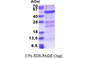 DNA (Cytosine-5-)-Methyltransferase 3 Like (TRDMT1) (AA 1-387) protein (His tag)