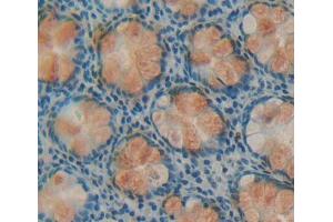 Used in DAB staining on fromalin fixed paraffin- embedded rectum tissue (DPP3 抗体  (AA 2-261))