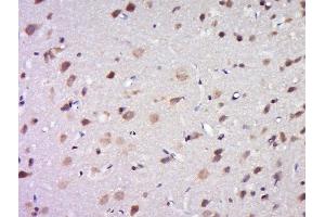 Paraformaldehyde-fixed, paraffin embedded rat brain tissue, Antigen retrieval by boiling in sodium citrate buffer(pH6) for 15min, Block endogenous peroxidase by 3% hydrogen peroxide for 30 minutes, Blocking buffer (normal goat serum) at 37°C for 20min, Antibody incubation with Rabbit Anti-DPAGT1 Polyclonal Antibody, Unconjugated  at 1:500 overnight at 4°C, followed by a conjugated secondary and DAB staining (DPAGT1 抗体  (AA 301-408))