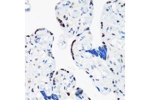 Immunohistochemistry of paraffin-embedded human placenta using T Rabbit mAb (ABIN7270729) at dilution of 1:100 (40x lens).