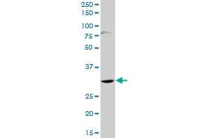 HOXD1 MaxPab rabbit polyclonal antibody. (HOXD1 抗体  (AA 1-328))