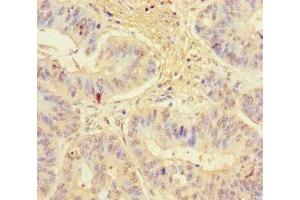 Immunohistochemistry (IHC) image for anti-Killer Cell Lectin-Like Receptor Subfamily G, Member 1 (KLRG1) (AA 60-195) antibody (ABIN7157538)