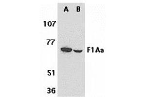 Western Blotting (WB) image for anti-Fem-1 Homolog B (FEM1B) (C-Term) antibody (ABIN1030384) (FEM1B 抗体  (C-Term))