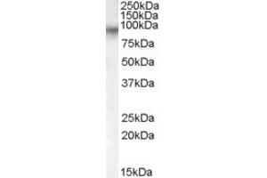 Western Blotting (WB) image for anti-Coagulation Factor XIII, A1 Polypeptide (F13A1) (AA 703-717) antibody (ABIN291434) (F13A1 抗体  (AA 703-717))