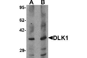 Western blot analysis of HepG2 in 293 cell lysate with DLK1 antibody at (A) 1 and (B) 2 µg/mL. (DLK1 抗体  (C-Term))