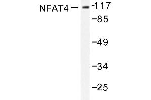 Image no. 1 for anti-Nuclear Factor of Activated T-Cells, Cytoplasmic, Calcineurin-Dependent 3 (NFATC3) antibody (ABIN272044) (NFATC3 抗体)