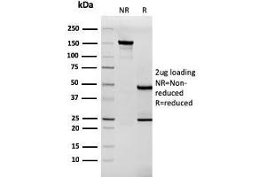 SDS-PAGE Analysis Purified Tenascin C Mouse Recombinant Monoclonal Antibody (TNC/3635). (Recombinant TNC 抗体)