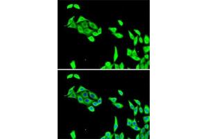 Immunofluorescence (IF) image for anti-Cyclin-Dependent Kinase 5 (CDK5) (AA 1-292) antibody (ABIN6138319)