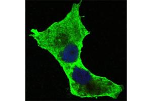 Confocal immunofluorescence analysis of Hela cells using DAXX antibody (green). (DAXX 抗体)