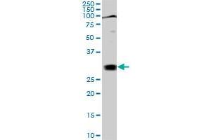 TGIF2 monoclonal antibody (M02), clone 5B11. (TGIF2 抗体  (AA 131-236))