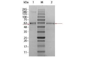 SDS-PAGE of AKT2 Human Recombinant Protein. (AKT2 蛋白)