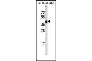 Western blot analysis of  Lysyl oxidase Antibody (Center) in MDA-MB468 cell line lysates (35ug/lane). (LOX 抗体  (Middle Region))