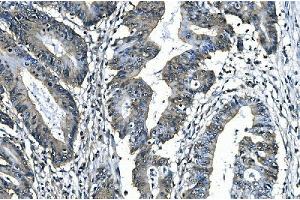 IHC analysis of SLBP using anti-SLBP antibody (ABIN7600074). (SLBP 抗体  (AA 146-270))