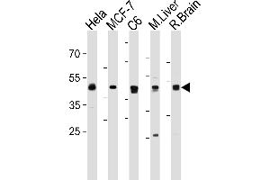 MEK2 (P2K2) Antibody (N-term) (ABIN1882178 and ABIN2842061) western blot analysis in Hela,MCF-7,rat C6 cell line and mouse Liver,rat Brain tissue lysates (35 μg/lane).