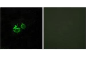 Immunofluorescence analysis of HuvEc cells, using GHRHR Antibody. (GHRHR 抗体  (AA 351-400))