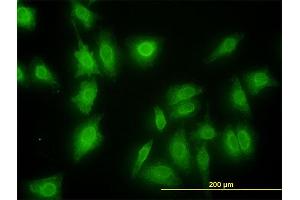 Immunofluorescence of monoclonal antibody to MKNK1 on HeLa cell. (MKNK1 抗体  (AA 1-465))