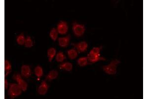 ABIN6272242 staining Hela by IF/ICC. (APOBEC3A 抗体)