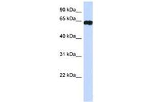 Image no. 1 for anti-Hypermethylated in Cancer 2 (HIC2) (AA 395-444) antibody (ABIN6742231) (HIC2 抗体  (AA 395-444))