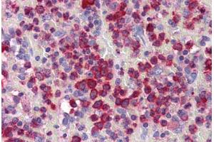 Human Spleen (formalin-fixed, paraffin-embedded) stained with GZMB antibody ABIN351505 at 10 ug/ml followed by biotinylated goat anti-rabbit IgG secondary antibody ABIN481713, alkaline phosphatase-streptavidin and chromogen. (GZMB 抗体  (N-Term))