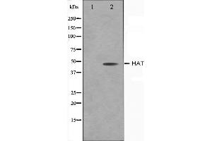 Western blot analysis on LOVO cell lysate using HAT Antibody,The lane on the left is treated with the antigen-specific peptide. (HAT1 抗体  (C-Term))