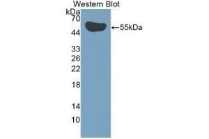 Detection of Recombinant IL35, Human using Polyclonal Antibody to Interleukin 35 (IL35) (Interleukin 35 抗体  (AA 23-219))