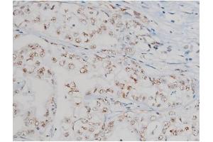 Immunohistochemistry (IHC) image for anti-Glial Fibrillary Acidic Protein (GFAP) (pSer38) antibody (ABIN6256306)