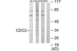 Western Blotting (WB) image for anti-Cyclin-Dependent Kinase 1 (CDK1) (Internal Region) antibody (ABIN1849110) (CDK1 抗体  (Internal Region))