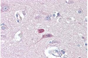 Anti-GRM4 / MGLUR4 antibody IHC staining of human brain, cortex. (Metabotropic Glutamate Receptor 4 抗体  (AA 851-900))