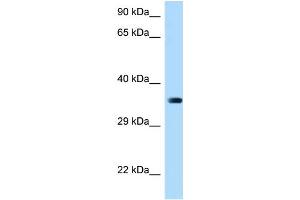 WB Suggested Anti-March2 Antibody Titration: 1. (MARCH2 抗体  (Middle Region))