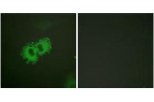 Immunofluorescence analysis of HeLa cells, using Caldesmon (Phospho-Ser789) Antibody. (Caldesmon 抗体  (pSer789))