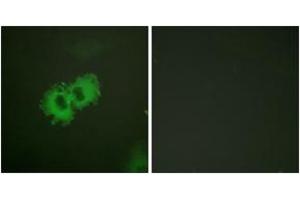 Immunofluorescence analysis of HeLa cells, using Caldesmon (Phospho-Ser789) Antibody.