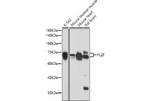 Western blot analysis of extracts of various cell lines, using PLZF antibody (ABIN6128472, ABIN6150368, ABIN6150369 and ABIN6221570) at 1:2654 dilution. (ZBTB16 抗体  (AA 1-220))