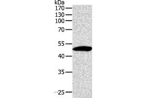 Western blot analysis of Mouse thymus tissue, using SIRT6 Polyclonal Antibody at dilution of 1:350 (SIRT6 抗体)