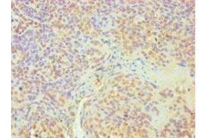 Immunohistochemistry of paraffin-embedded human tonsil tissue using ABIN7164363 at dilution of 1:100 (DDX5 抗体  (AA 1-290))