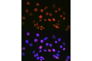 Immunofluorescence analysis of NIH-3T3 cells using mSin3A Rabbit mAb (ABIN7270318) at dilution of 1:100 (40x lens). (SIN3A 抗体)