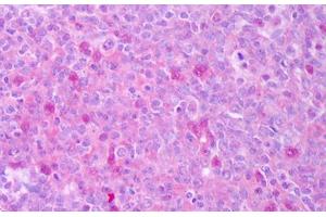 Immunohistochemistry (IHC) image for anti-CD40 Ligand (CD40LG) antibody (ABIN1100607)
