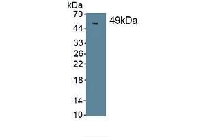 Detection of Recombinant SPC, Human using Monoclonal Antibody to Surfactant Protein C (SP-C) (Surfactant Protein C 抗体  (AA 24-197))