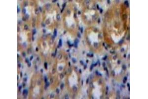Used in DAB staining on fromalin fixed paraffin-embedded Kidney tissue (PLAA 抗体  (AA 20-143))