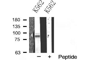 Western blot analysis of ADAM10 expression in K562 cells (ADAM10 抗体  (Internal Region))