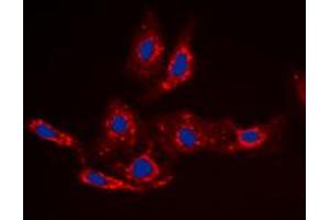 Immunofluorescent analysis of Beta-catenin (pS33) staining in HepG2 cells. (beta Catenin 抗体  (N-Term, pSer33))