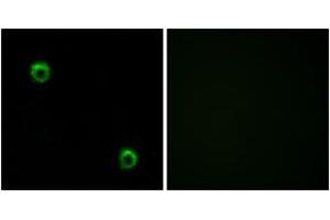 Immunofluorescence analysis of MCF7 cells, using FZD2 Antibody. (FZD2 抗体  (AA 201-250))