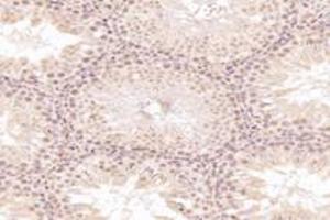 Immunohistochemistry analysis of paraffin-embedded rat testis using,MED3 (ABIN7074581) at dilution of 1: 7200 (MED27 抗体)