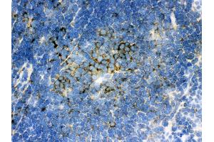Anti- SQSTM1 Picoband antibody,IHC(F) IHC(F): Mouse Spleen Tissue (SQSTM1 抗体  (N-Term))