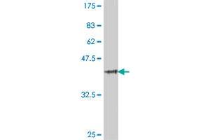 Western Blot detection against Immunogen (39. (TLR5 抗体  (AA 517-634))