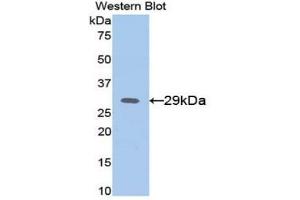 Detection of Recombinant AFP, Mouse using Polyclonal Antibody to Alpha-Fetoprotein (AFP) (alpha Fetoprotein 抗体  (AA 399-605))